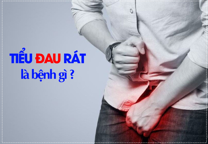 Tiểu đau rát là bệnh gì ?