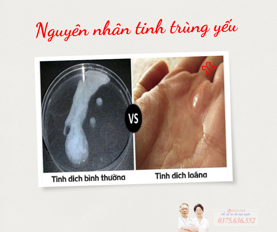 Nguyên nhân tinh trùng yếu